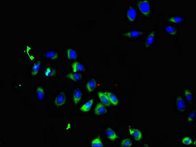 SMO Antibody
