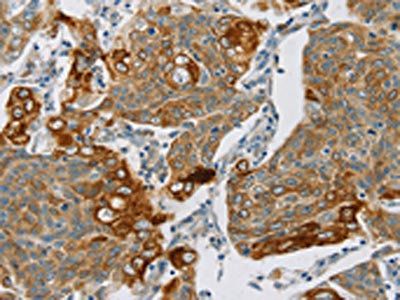 SMOC2 antibody