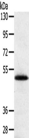 SMOC2 Antibody
