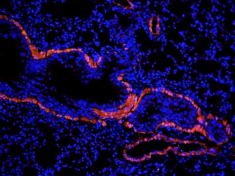 ACTA2 antibody