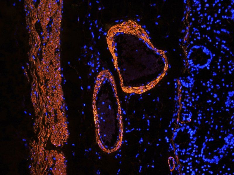 ACTA2 antibody