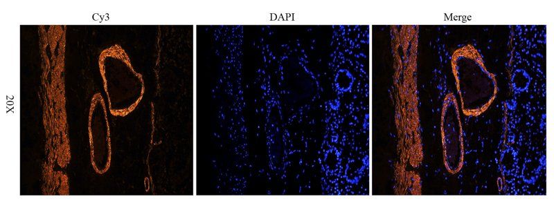 ACTA2 antibody