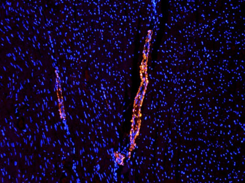 ACTA2 antibody