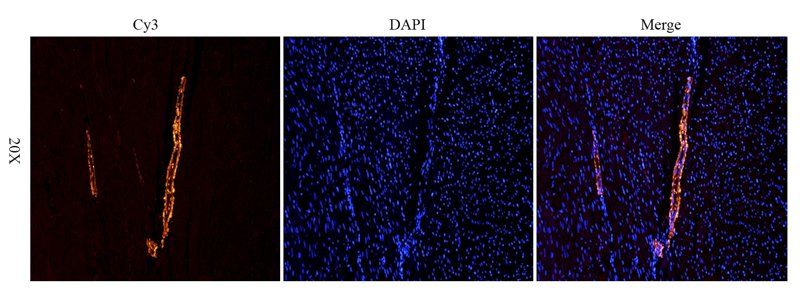 ACTA2 antibody