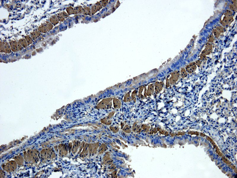 ACTA2 antibody