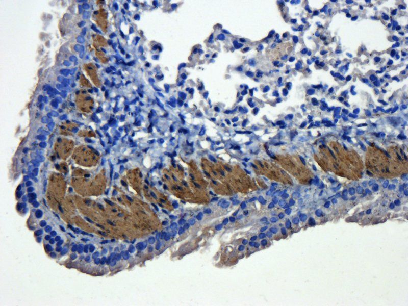 ACTA2 antibody