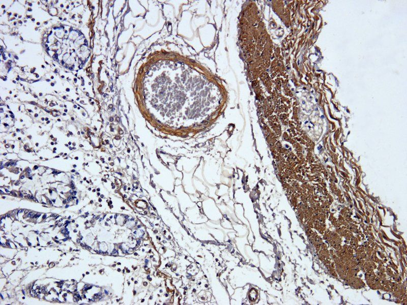 ACTA2 antibody