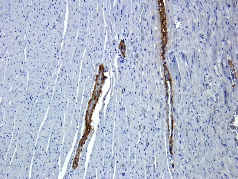 ACTA2 antibody