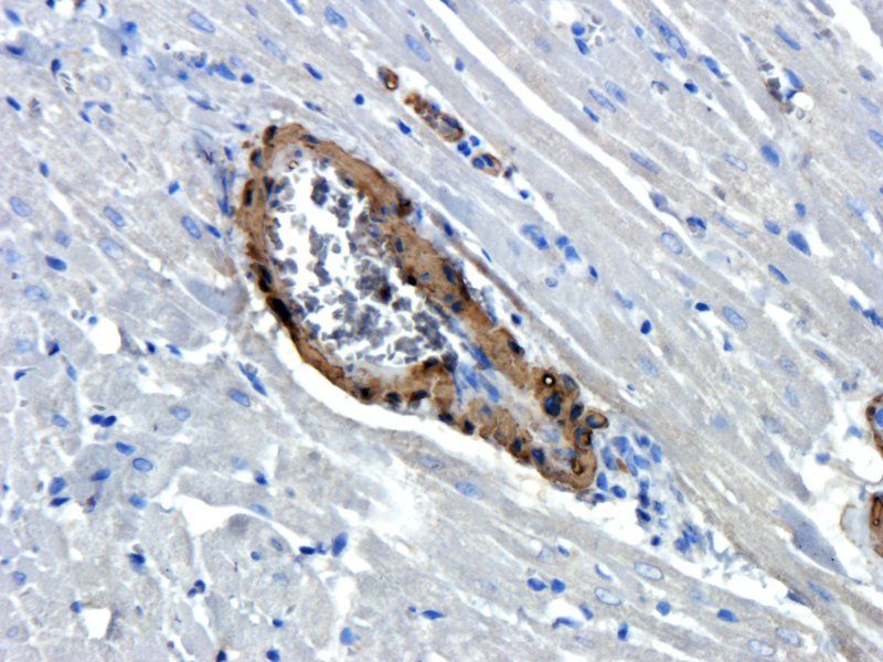 ACTA2 antibody