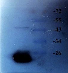 ACTA2 antibody