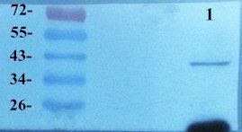 ACTA2 antibody