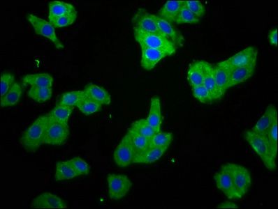 SMPD2 antibody