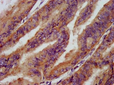 SMPD2 Antibody