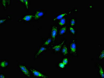 SMS Antibody