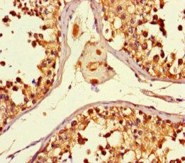 SMYD2 antibody