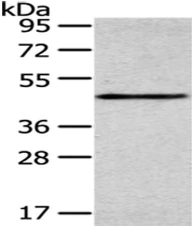 SMYD2 antibody