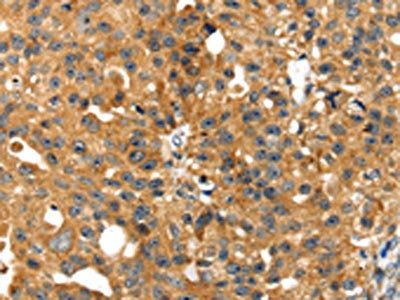 SMYD4 Antibody