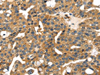 SMYD4 Antibody