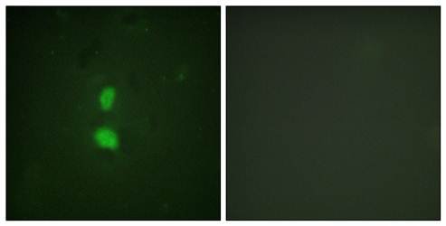 SNAI1 (Phospho-Ser246) Antibody