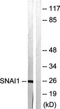 SNAI1 (Ab-246) Antibody