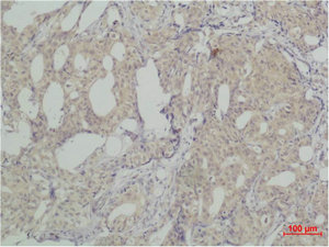 SNAI2 Antibody