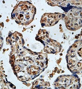 SNAI2 Rabbit Polyclonal Antibody