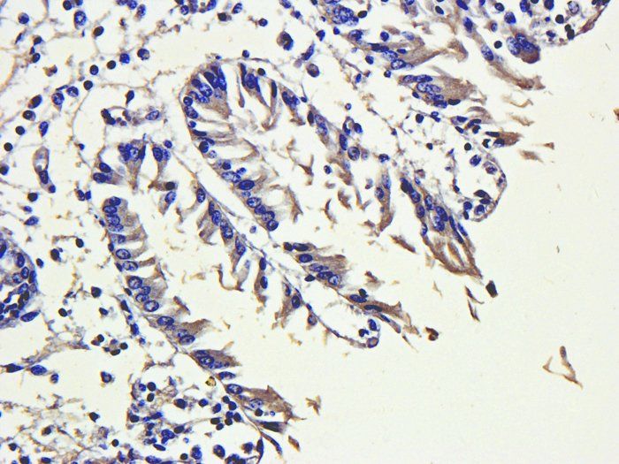 SNAIL antibody