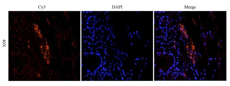 Snail antibody