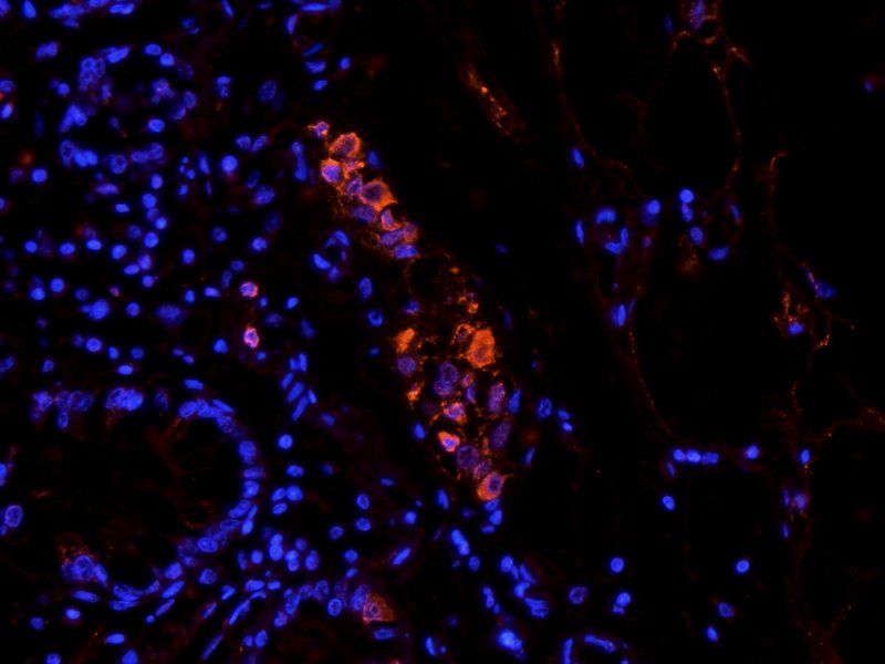 Snail antibody