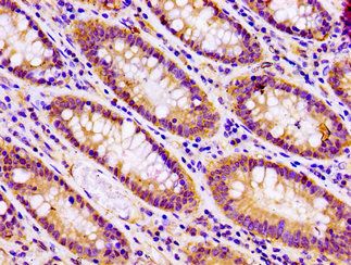 SNAP23 Antibody
