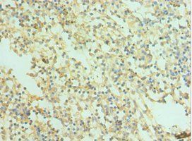SNAP25 Antibody