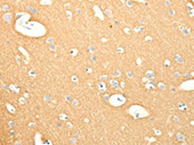 SNAP25 Antibody