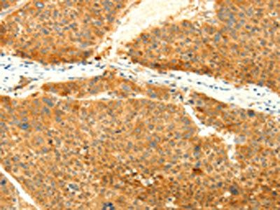 SNAP25 Antibody