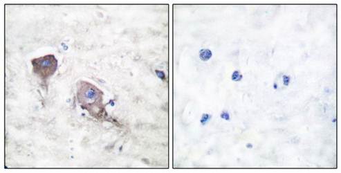 SNAP25 Antibody
