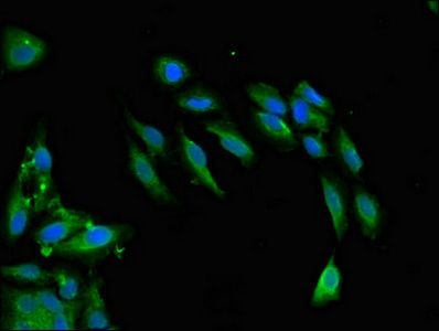 SNCAIP Antibody
