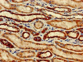 SNCAIP Antibody