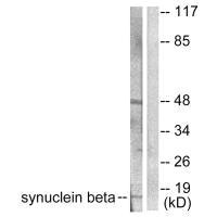 SNCB antibody