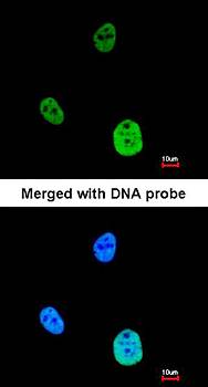 SNRK antibody