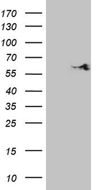 SNRPB2 Antibody