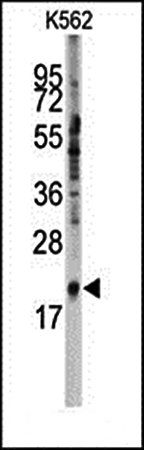 SNRPC antibody