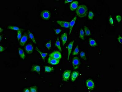 SNRPD1 Antibody
