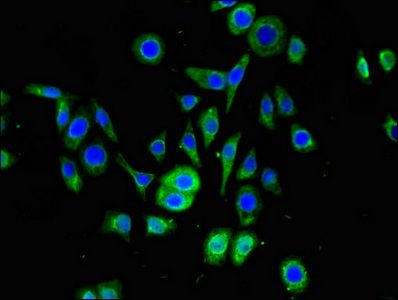 SNRPD1 antibody