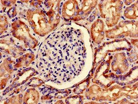 SNRPD1 Antibody