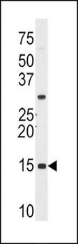SNRPD1 antibody