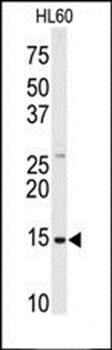 SNRPD1 antibody