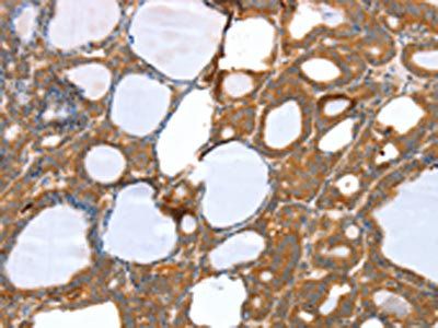 SNX11 Antibody