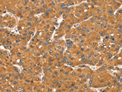 SNX11 Antibody