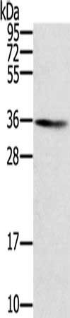 SNX11 antibody