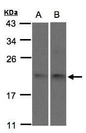 sorting nexin 12 Antibody