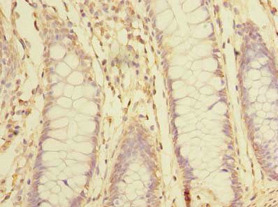 SNX16 antibody